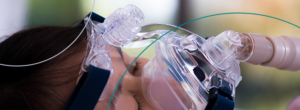 Bariatric surgery for Sleep Apnea